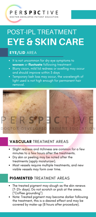 ipl aftercare card at home care post ipl treatment for dry eye for optometrists dermatologists perspective docs 