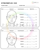 radiofrequency and ipl treatment logs for optometrists dry eye dermatologists perspective docs